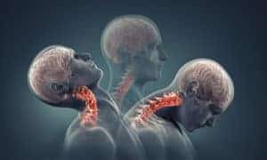 Treating Spinal Trauma | AICA Orthopedics