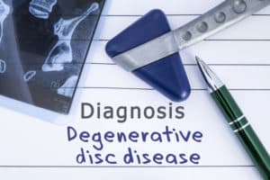 what is degenerative disc disease
