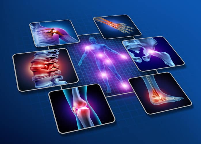 Why Do Joints Develop Arthritis