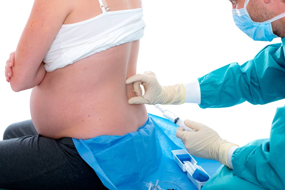 Back Pain After Epidural Causes and Treatments