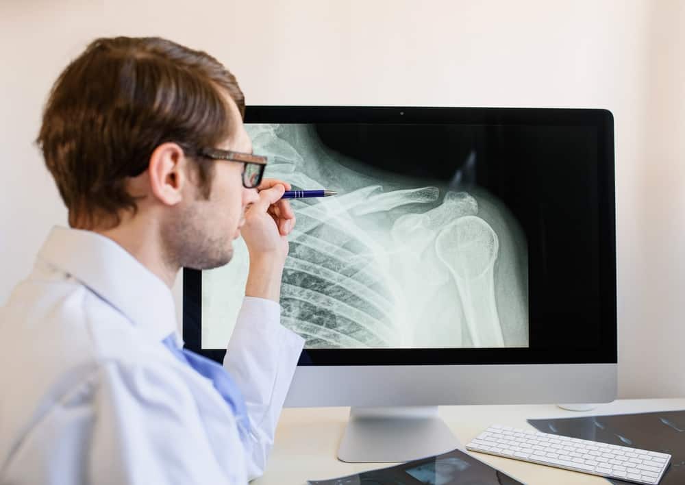 Broken Collarbone Symptoms and Treatment
